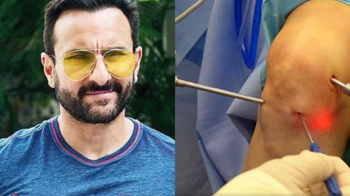 Actor Saif Ali Khan Admitted To Hospital For Knee Surgery; Fracture In Shoulder