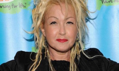 Cyndi Lauper Shares Tips For Managing Psoriasis Symptoms