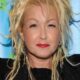 Cyndi Lauper Shares Tips For Managing Psoriasis Symptoms