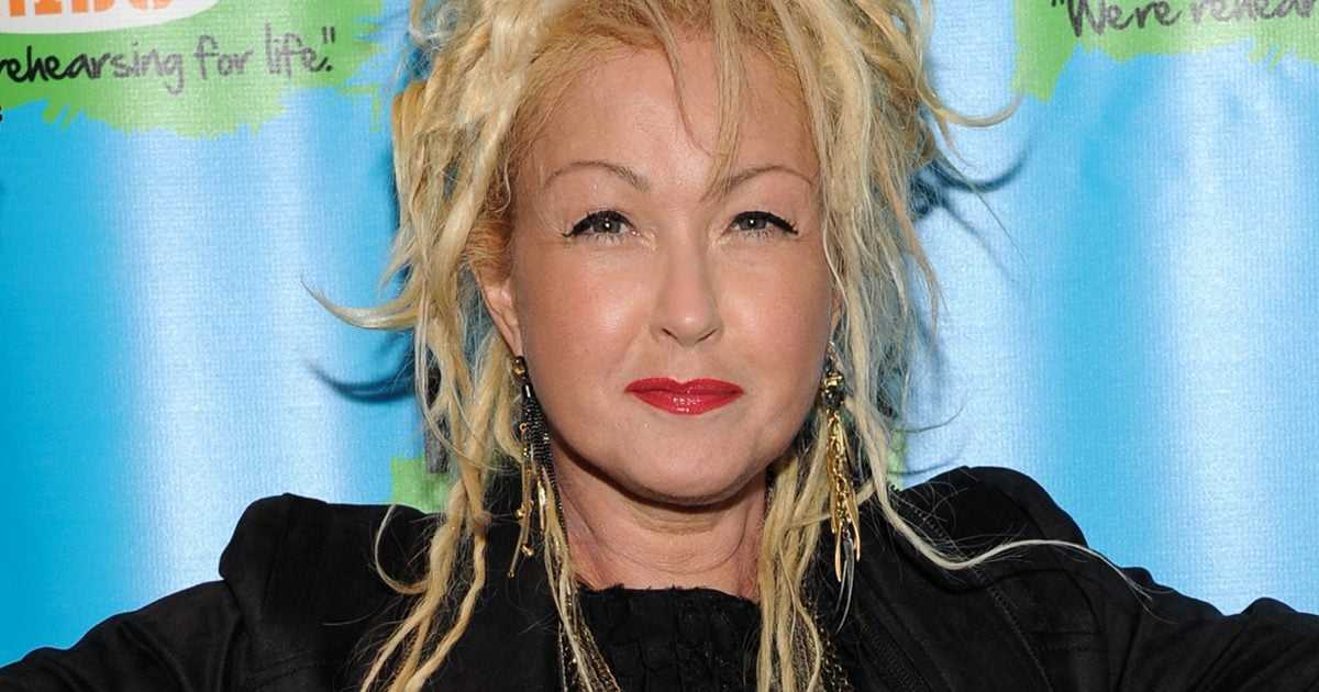 Cyndi Lauper Shares Tips For Managing Psoriasis Symptoms