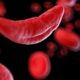 Hydroxyurea Reduces Infections In Children With Sickle Cell Anemia, New Study Shows