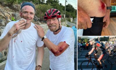 Billionaire Richard Branson Suffers Cycling Injuries In British Virgin Islands