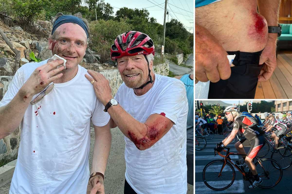 Billionaire Richard Branson Suffers Cycling Injuries In British Virgin Islands