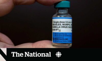 Measles Outbreak Prompts Urgent Vaccination Warnings In Canada