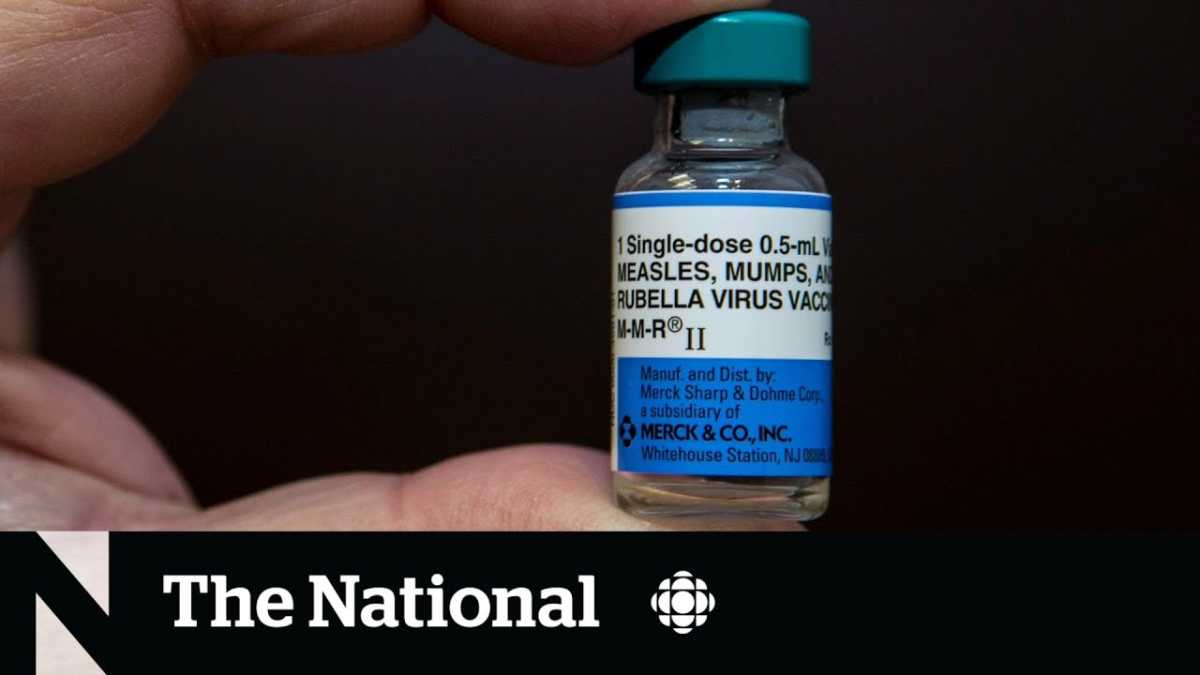 Measles Outbreak Prompts Urgent Vaccination Warnings In Canada