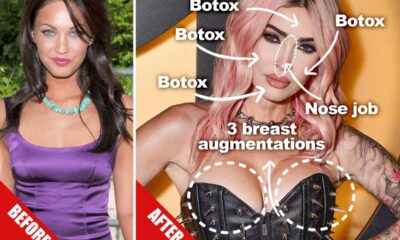 Megan Fox Reveals Candid Details About Past Surgeries And Superstitions