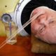 Polio Survivor 'man In The Iron Lung' Passes Away After 70 Years