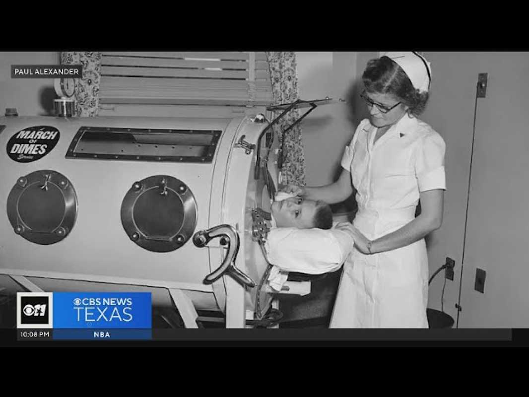 Remembering Paul Alexander: The Inspirational Journey Of 'the Man In The Iron Lung'