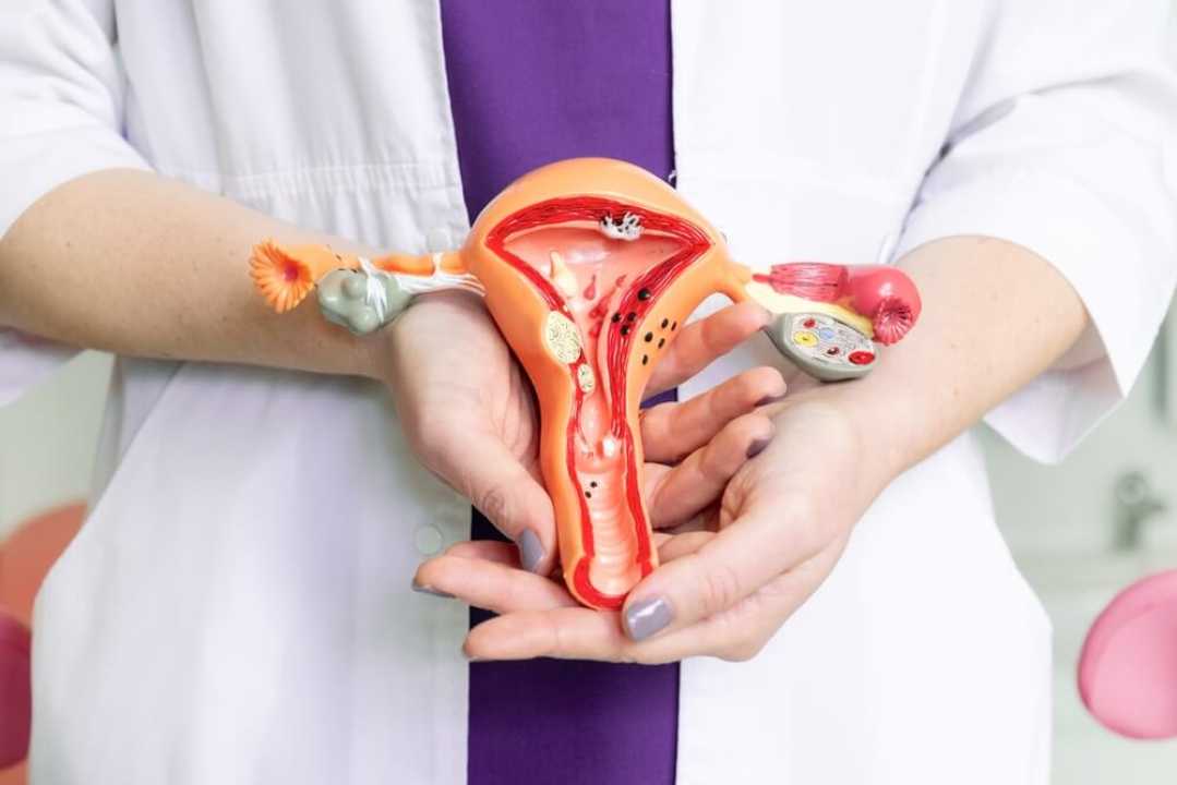 Decidual Cast Uterus