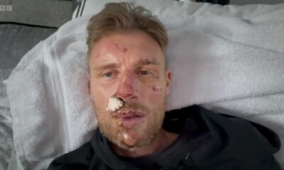 Freddie Flintoff Opens Up About Crash Injuries