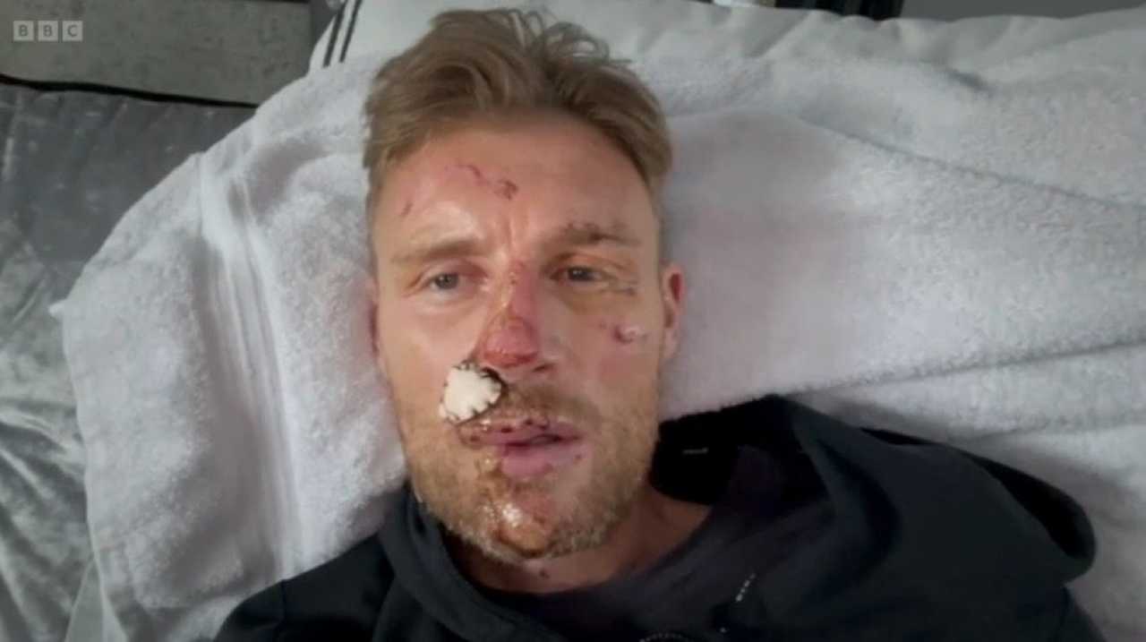 Freddie Flintoff Opens Up About Crash Injuries