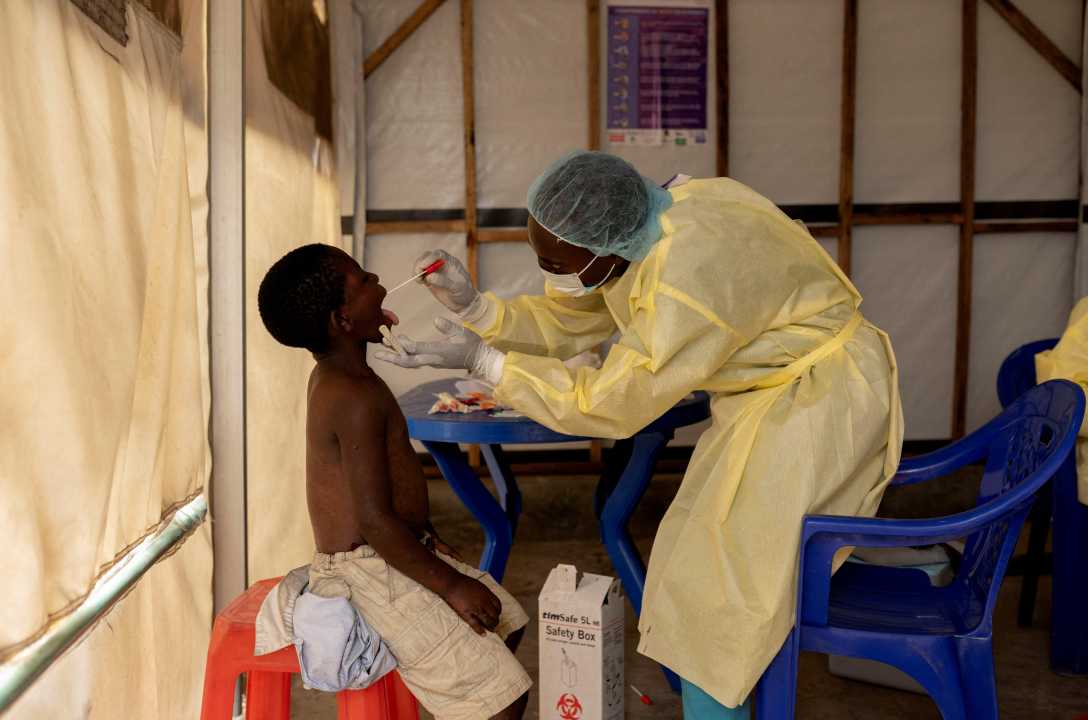 Mpox Outbreak In Africa Sparks Global Concern