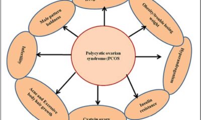 Elix Traditional Chinese Medicine Pcos