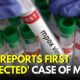 Mpox Virus News