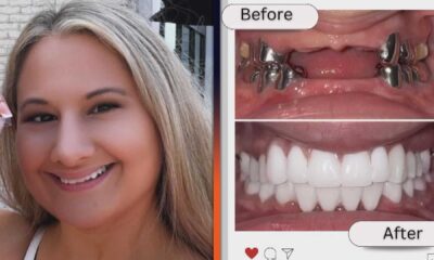 Gypsy Rose Blanchard Teeth Makeover