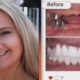 Gypsy Rose Blanchard Teeth Makeover