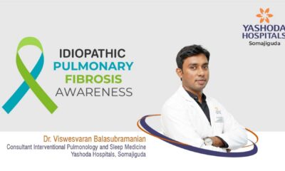 Idiopathic Pulmonary Fibrosis