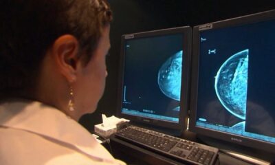 Ontario Mammogram Screening