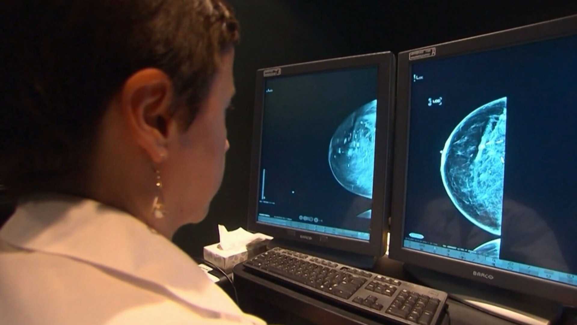 Ontario Mammogram Screening