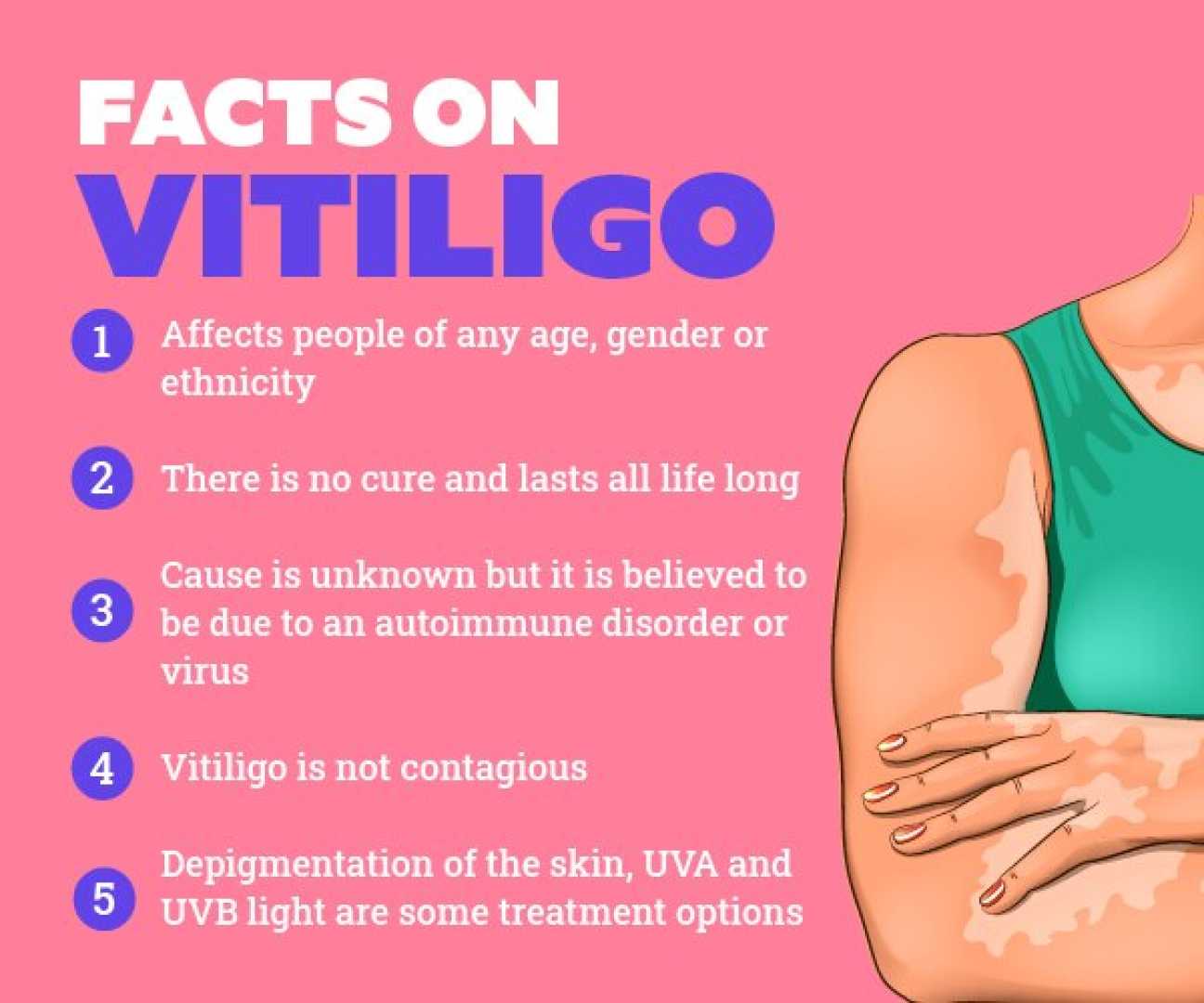 Vitiligo Treatment