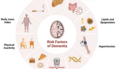 Type 2 Diabetes And Dementia Risk