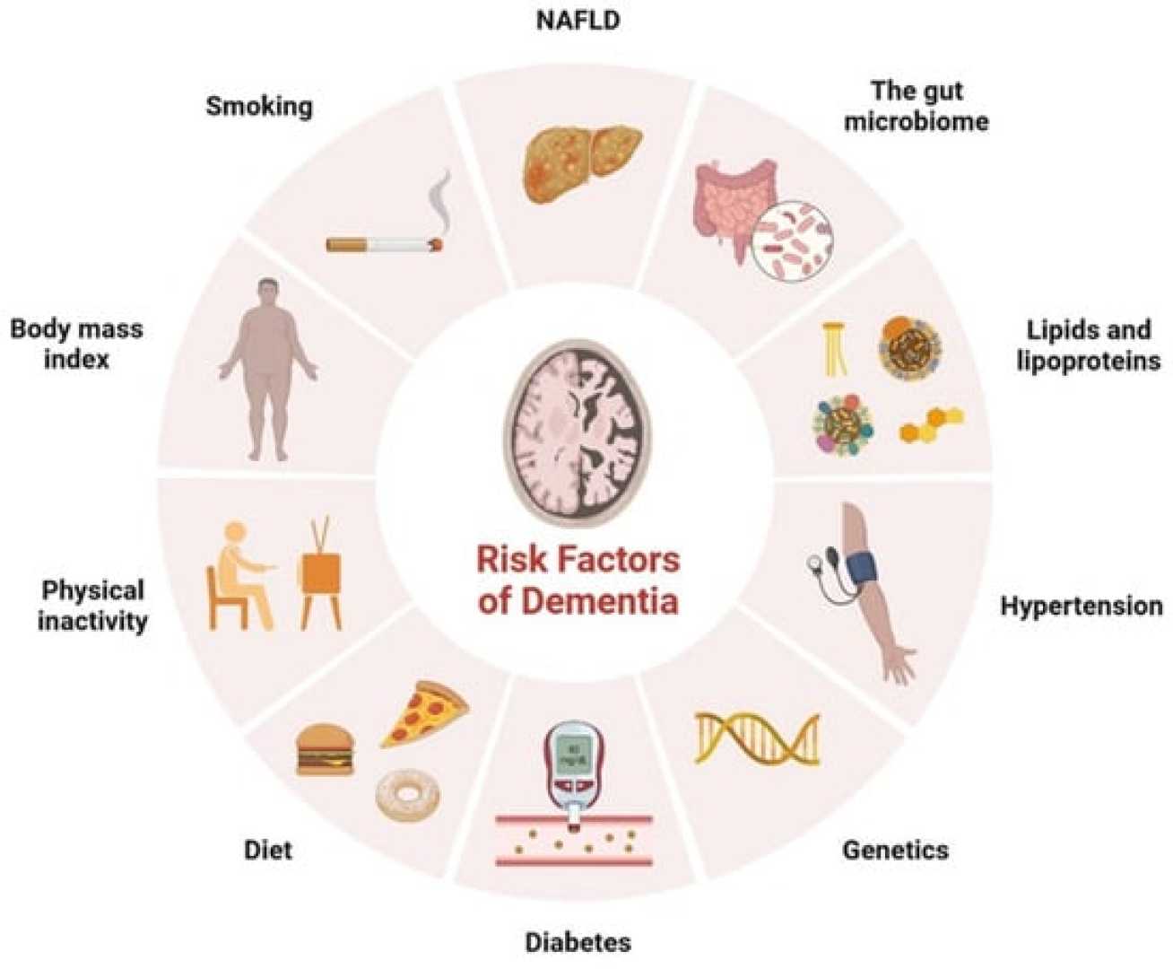 Type 2 Diabetes And Dementia Risk