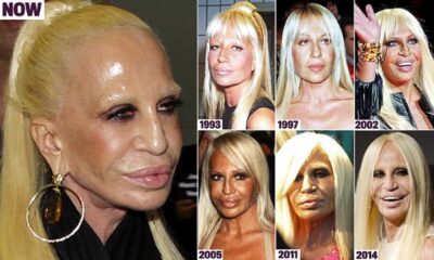 Donatella Versace New Face And Body