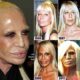 Donatella Versace New Face And Body