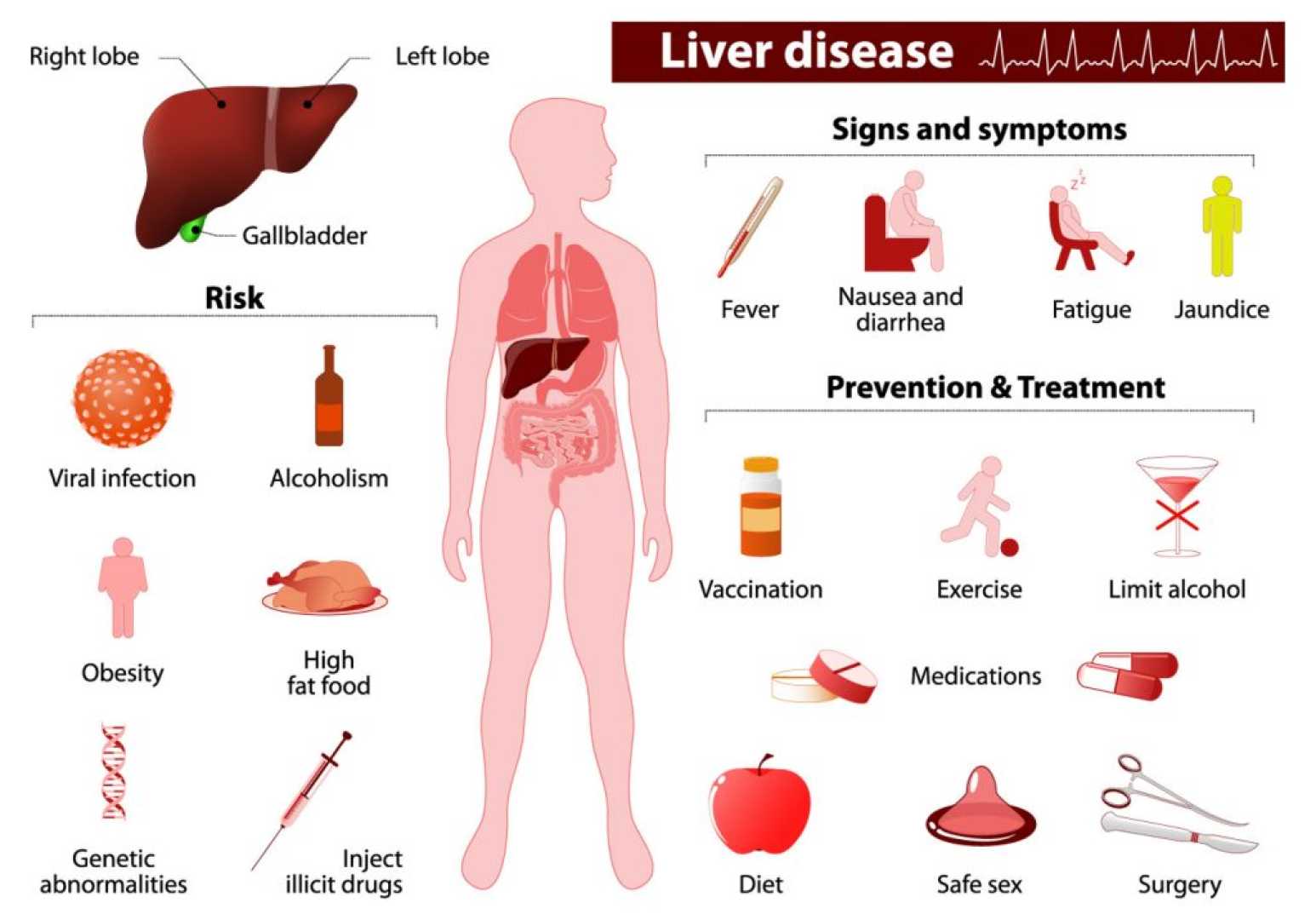 Liver Cancer Symptoms And Treatment