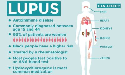 Lupus Symptoms And Diagnosis