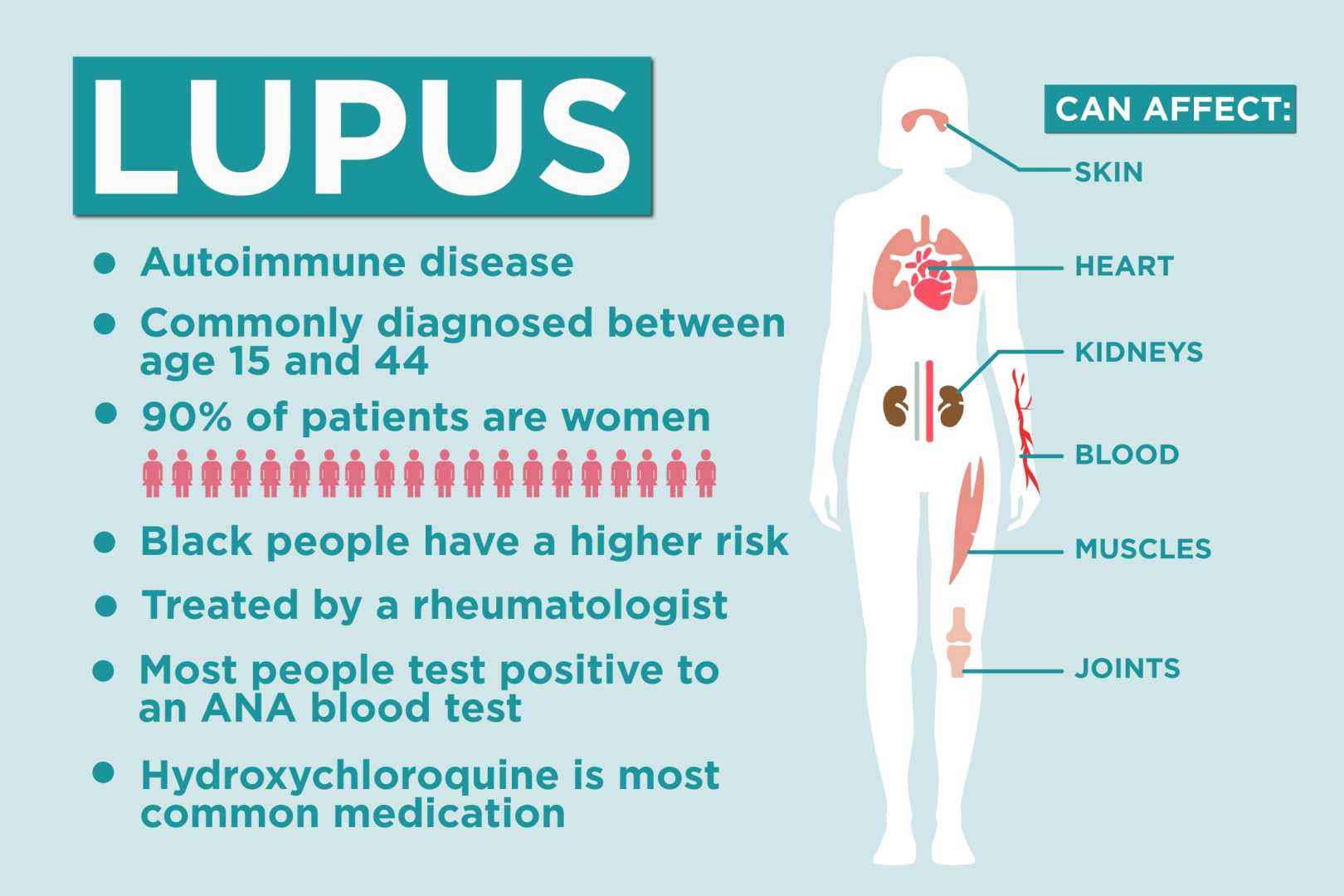 Lupus Symptoms And Diagnosis