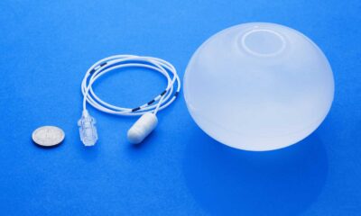 Allurion Gastric Balloon Weight Loss Technology