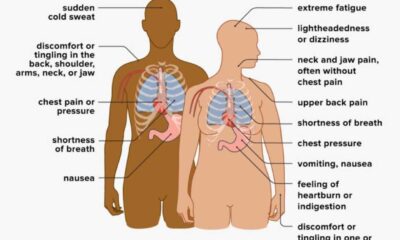 Heart Attack Warning Signs Chest Pain Diagram