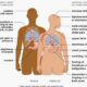 Heart Attack Warning Signs Chest Pain Diagram