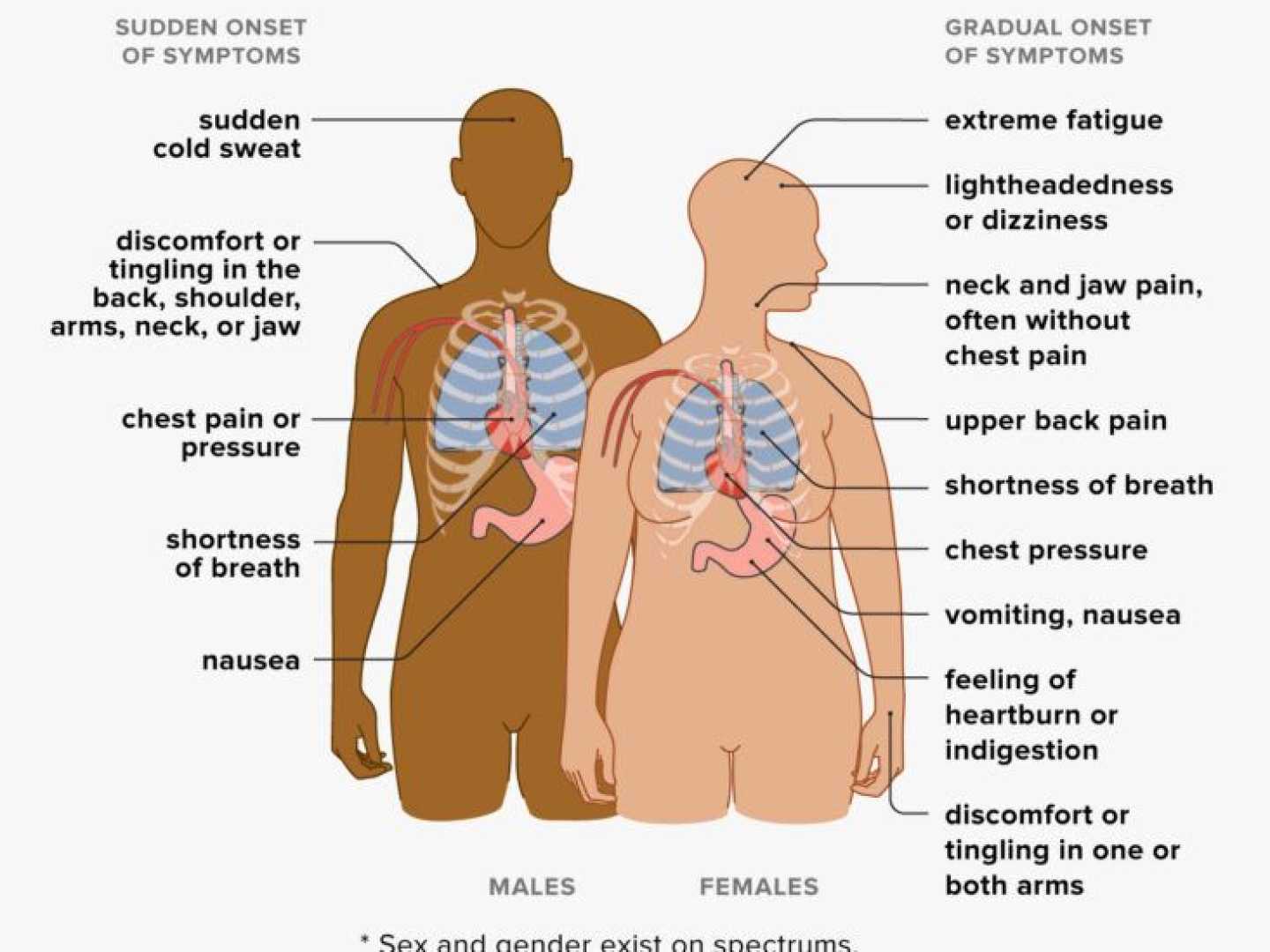 Heart Attack Warning Signs Chest Pain Diagram