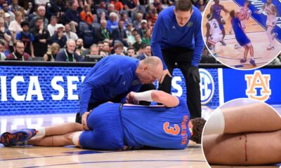 Florida Gators Basketball Injury Update