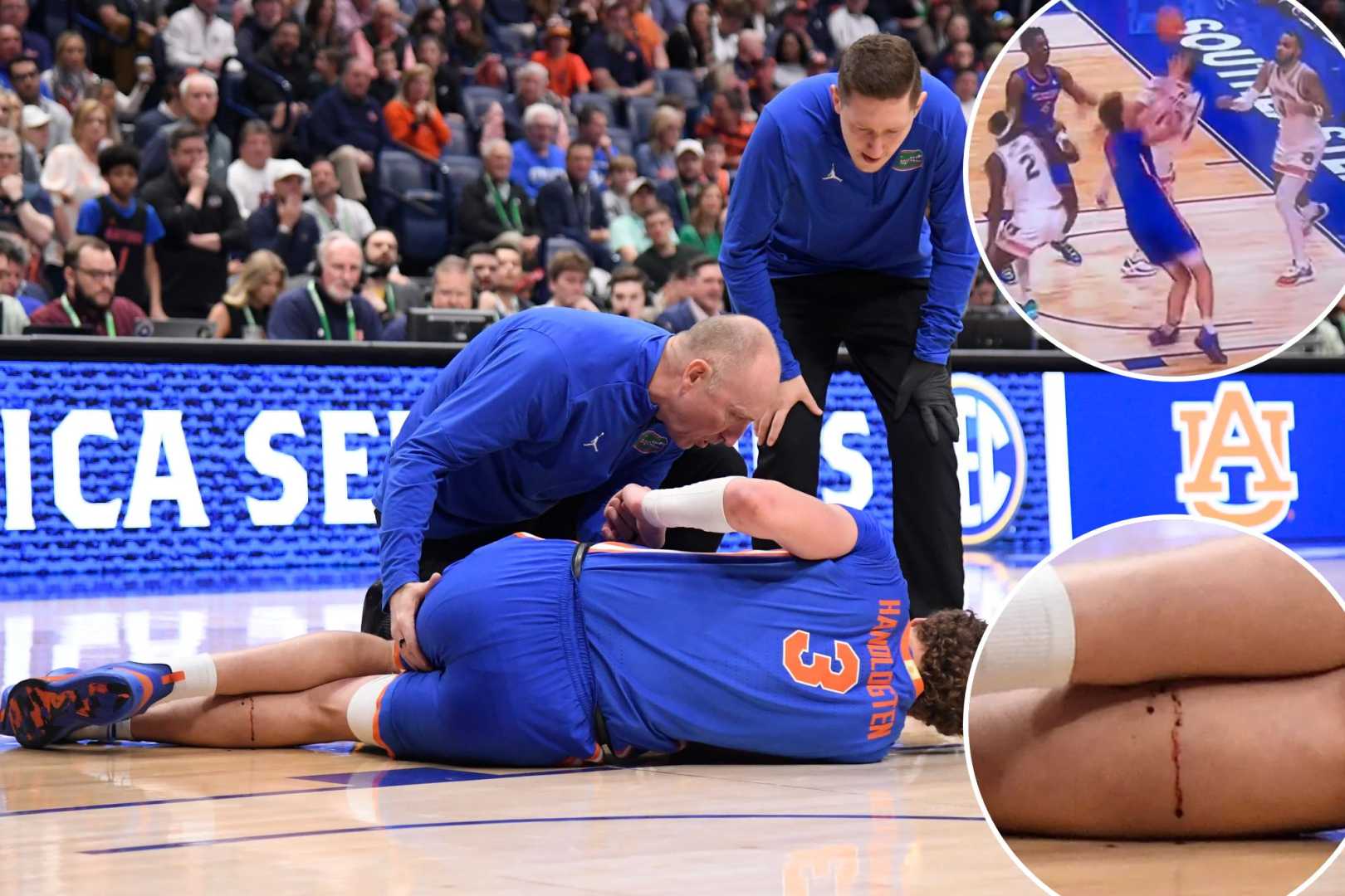 Florida Gators Basketball Injury Update