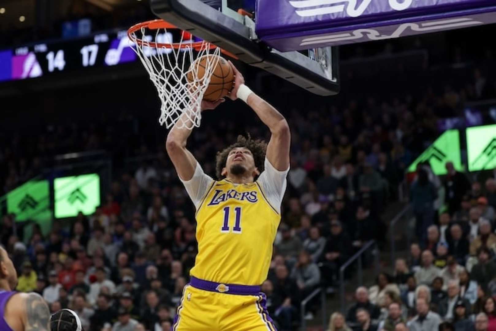 Jaxson Hayes Facial Contusion Injury Lakers Game