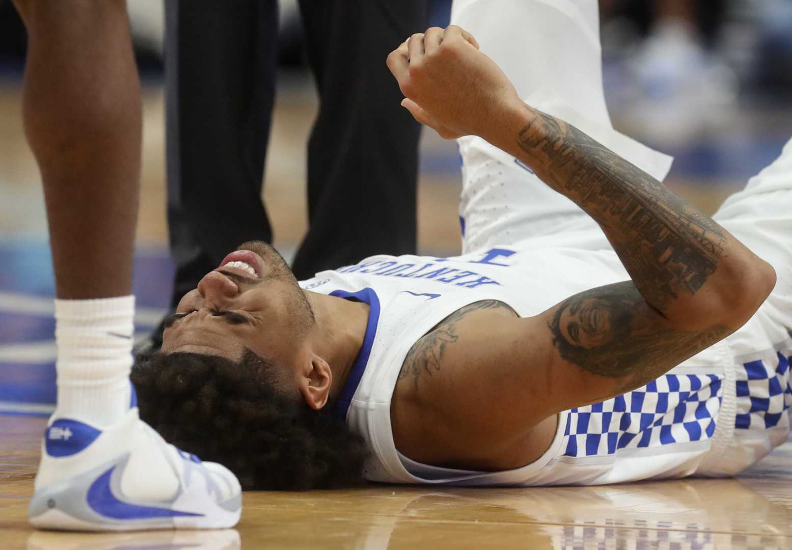 Kentucky Wildcats Basketball Practice Injuries