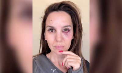 Christy Carlson Romano Shooting Range Accident