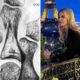 Ivanka Trump Paris Vacation Injury X Ray