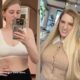 Meghan Trainor Breast Surgery Announcement