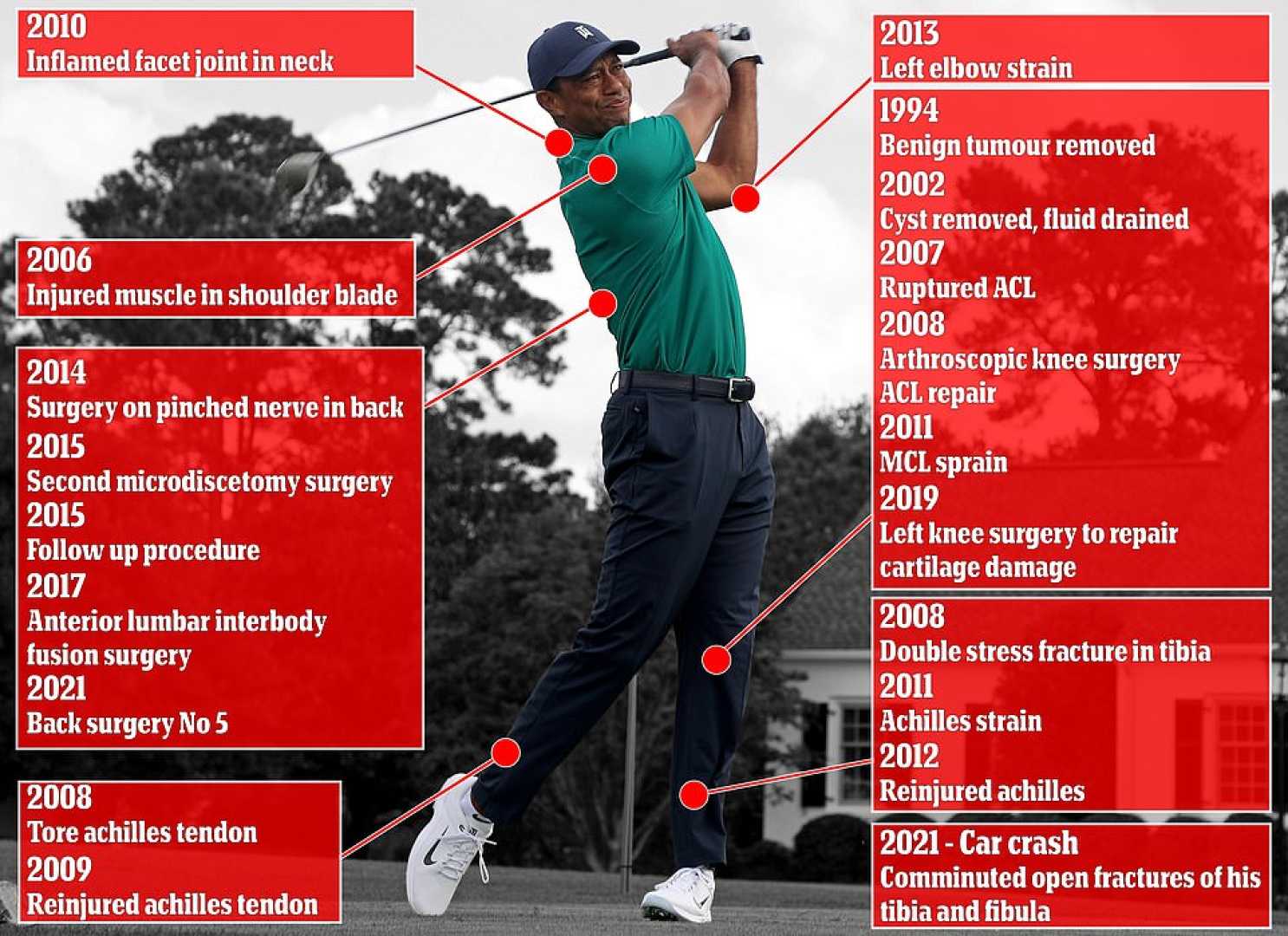 Tiger Woods Golf Injury Surgery