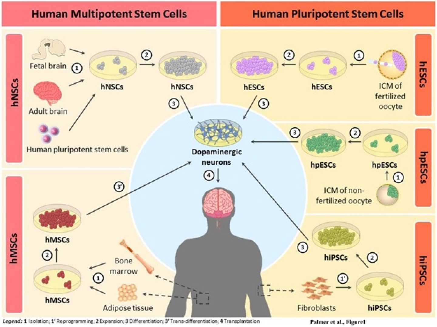 Stem Cell Therapy Parkinson's Disease Clinical Trials