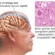Contaminated Human Growth Hormone Creutzfeldt Jakob Disease
