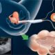 Egg Freezing Procedure Women Fertility Clinic