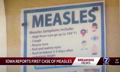 Iowa Measles Outbreak News