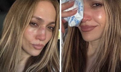 Jennifer Lopez Gesicht Verletzung Amas