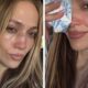 Jennifer Lopez Gesicht Verletzung Amas