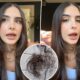 Sophia Umansky Mounjaro Hair Loss